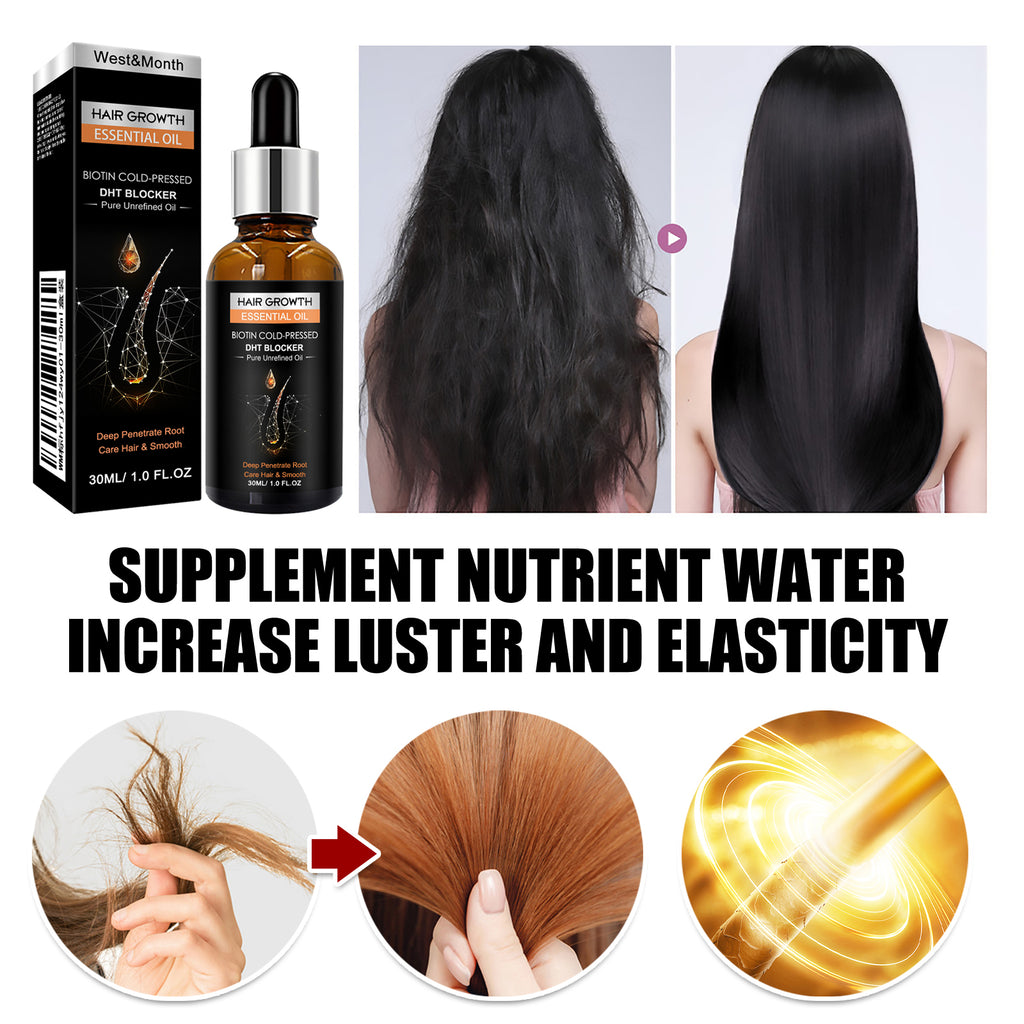 Hair Growth Essential Oil, Dense Hair Growth Repair Dry Hair And Moisture Hair Essence